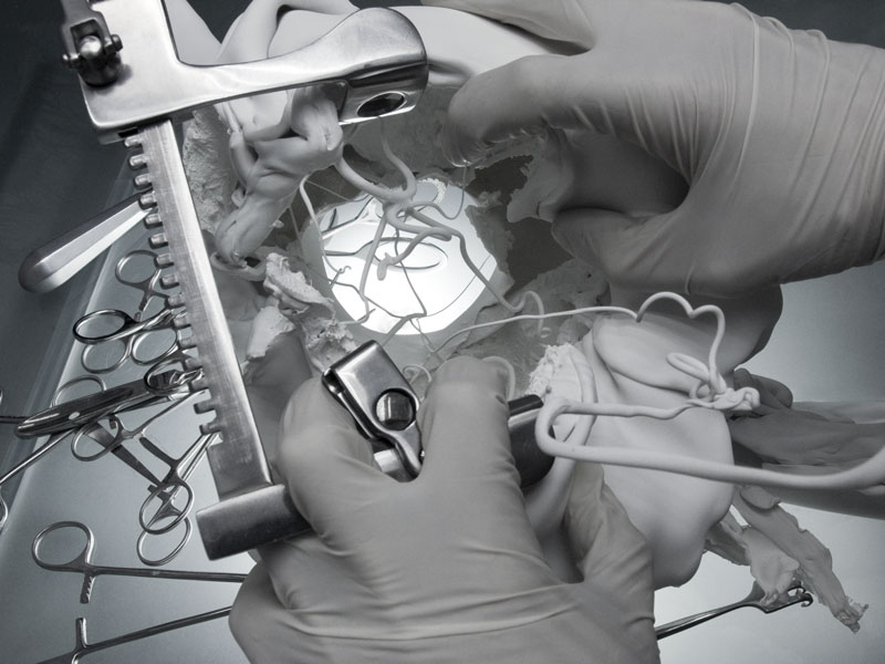 Trepanation of the thought-forms, 2007